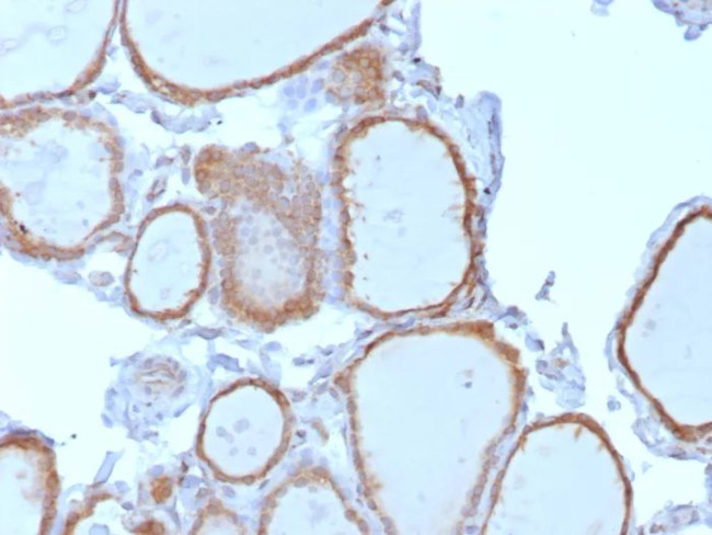 NTRK2 (Neurotrophic Receptor Tyrosine Kinase 2) Antibody in Immunohistochemistry (Paraffin) (IHC (P))