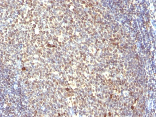 Nuclear Mitotic Apparatus Protein (NuMA) Antibody in Immunohistochemistry (Paraffin) (IHC (P))