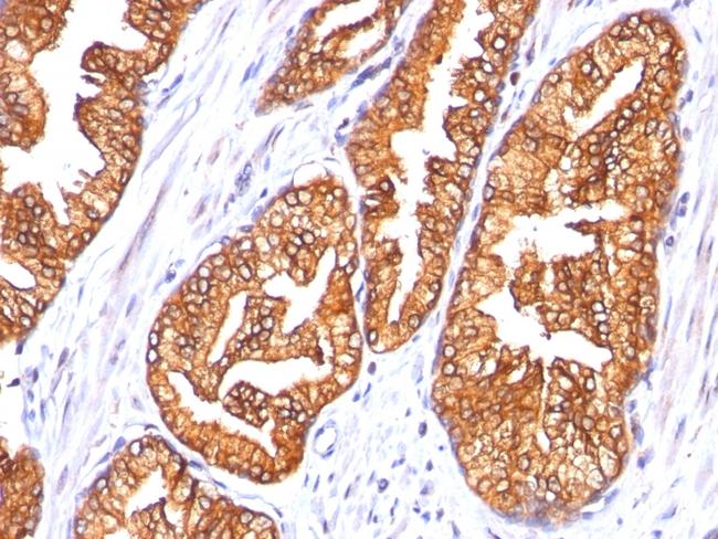 Ornithine Decarboxylase-1 (ODC-1) Antibody in Immunohistochemistry (Paraffin) (IHC (P))