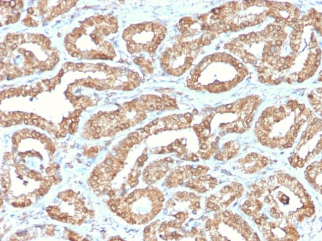 Ornithine Decarboxylase-1 (ODC-1) Antibody in Immunohistochemistry (Paraffin) (IHC (P))