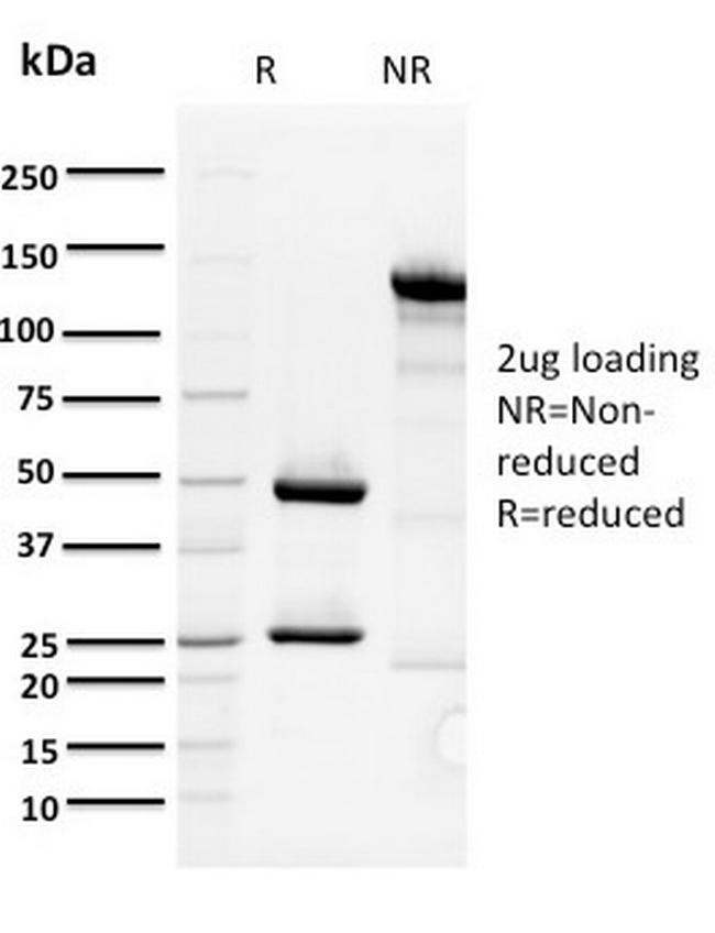 ORC1 Antibody in SDS-PAGE (SDS-PAGE)