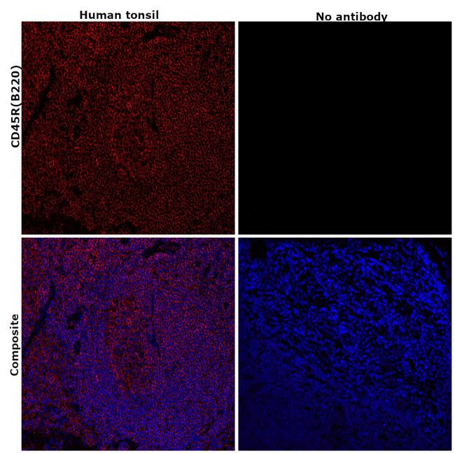 CD45R (B220) Antibody in Immunohistochemistry (Paraffin) (IHC (P))