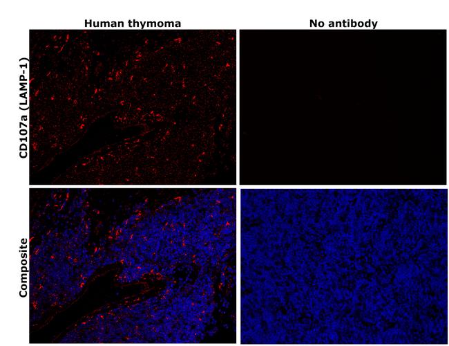 CD107a (LAMP-1) Antibody in Immunohistochemistry (Paraffin) (IHC (P))