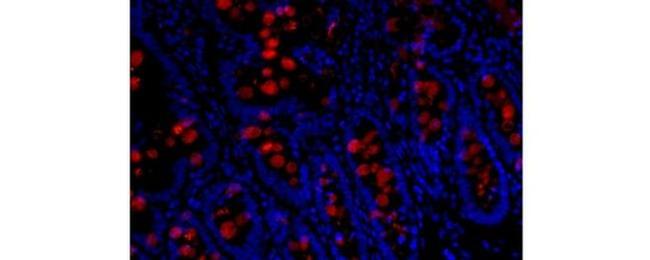 Trefoil Factor 3 Antibody in Immunohistochemistry (Paraffin) (IHC (P))