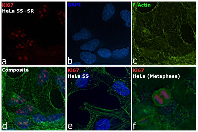 Ki-67 Antibody in Immunocytochemistry (ICC/IF)