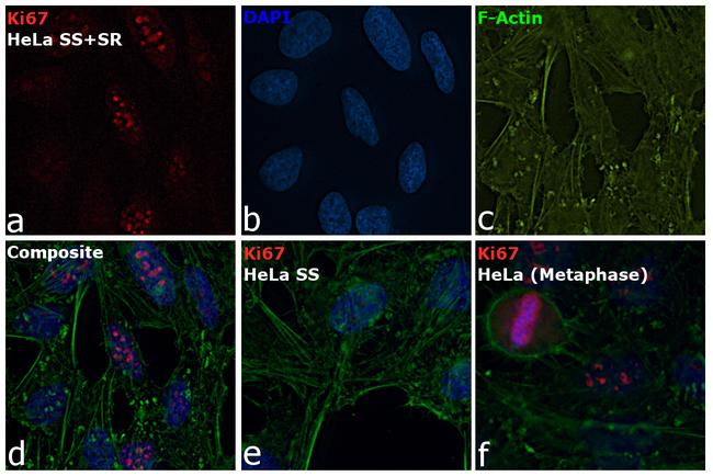 Ki-67 Antibody in Immunocytochemistry (ICC/IF)