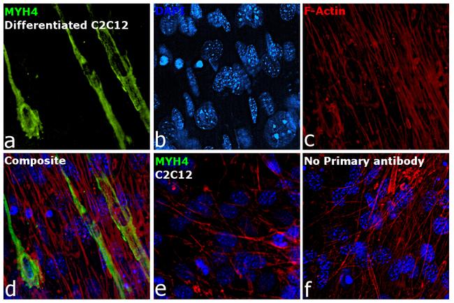 Myosin 4 Antibody in Immunocytochemistry (ICC/IF)