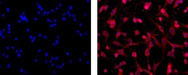 Oligodendrocyte Marker O1 Antibody in Immunocytochemistry (ICC/IF)