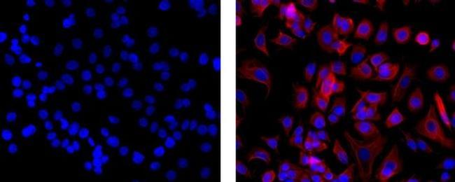 Pan Cytokeratin Antibody in Immunocytochemistry (ICC/IF)