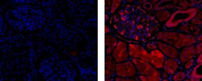 HSP70 Antibody in Immunohistochemistry (Paraffin) (IHC (P))