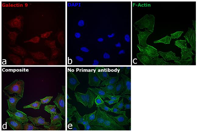 Galectin 9 Antibody in Immunocytochemistry (ICC/IF)