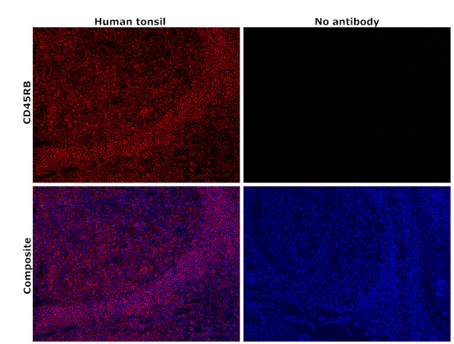 CD45RB Antibody in Immunohistochemistry (Paraffin) (IHC (P))