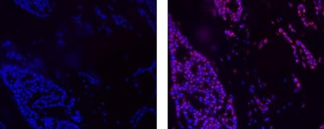 Cyclin E Antibody in Immunohistochemistry (Paraffin) (IHC (P))