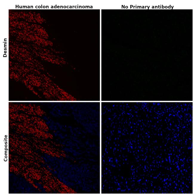 Desmin Antibody in Immunohistochemistry (Paraffin) (IHC (P))