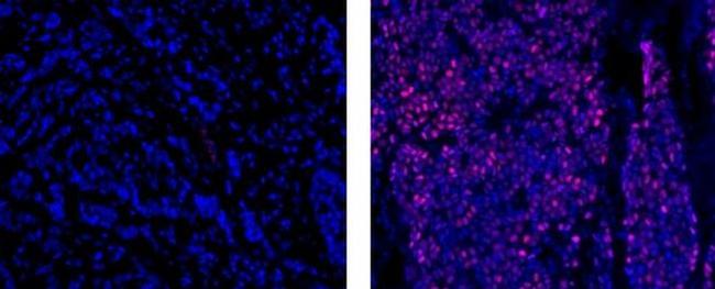 Progesterone Receptor Antibody in Immunohistochemistry (Paraffin) (IHC (P))