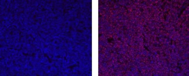 SOX11 Antibody in Immunohistochemistry (Paraffin) (IHC (P))