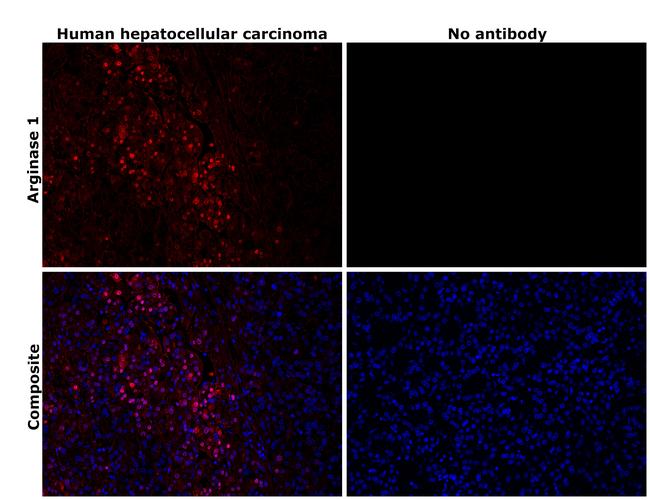 Arginase 1 Antibody in Immunohistochemistry (Paraffin) (IHC (P))