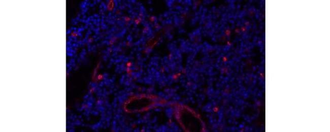 Cutaneous Lymphocyte Antigen (CLA) Antibody in Immunohistochemistry (Paraffin) (IHC (P))