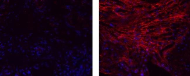 Collagen IV Antibody in Immunohistochemistry (Paraffin) (IHC (P))