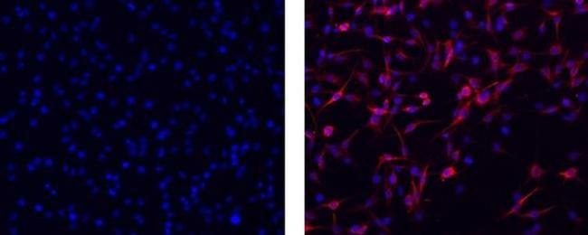 Vimentin Antibody in Immunocytochemistry (ICC/IF)