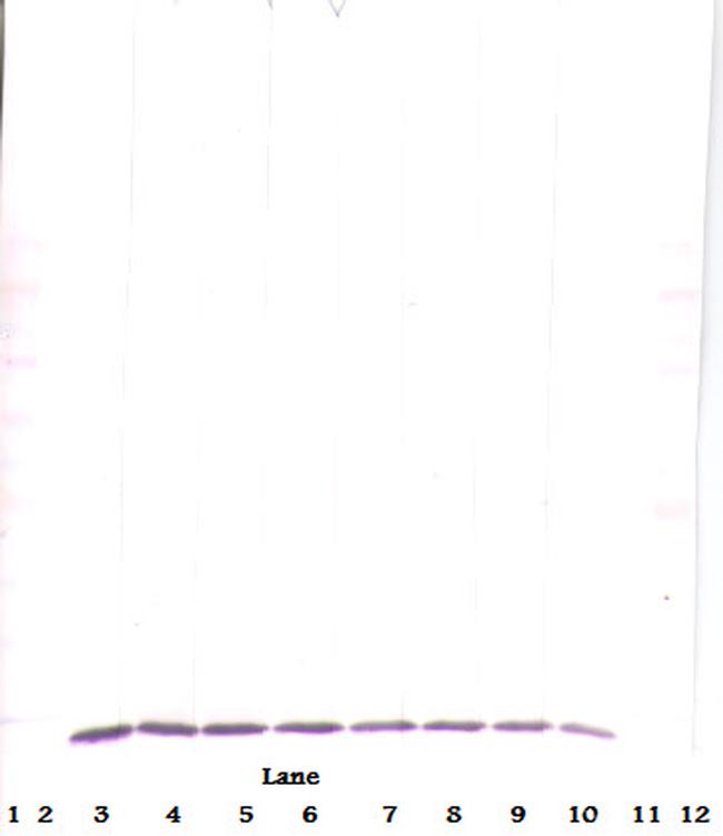 MCP-3 Antibody in Western Blot (WB)