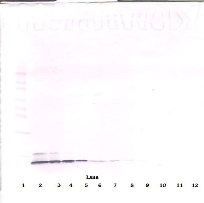 CCL5 (RANTES) Antibody in Western Blot (WB)