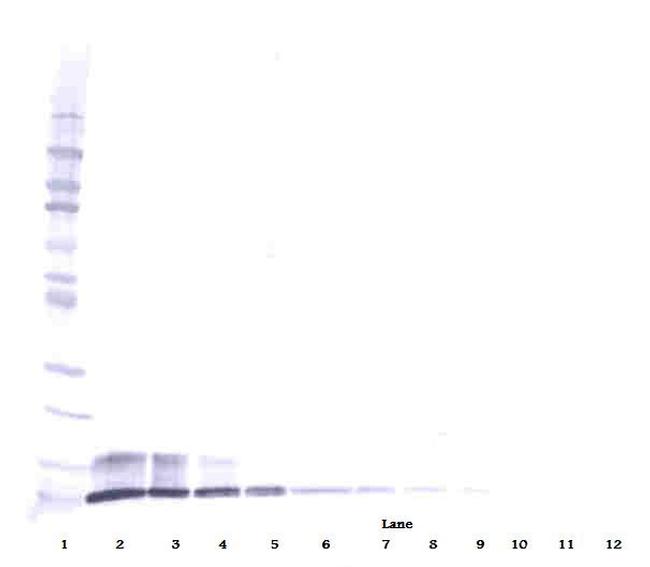 PPBP Antibody in Western Blot (WB)