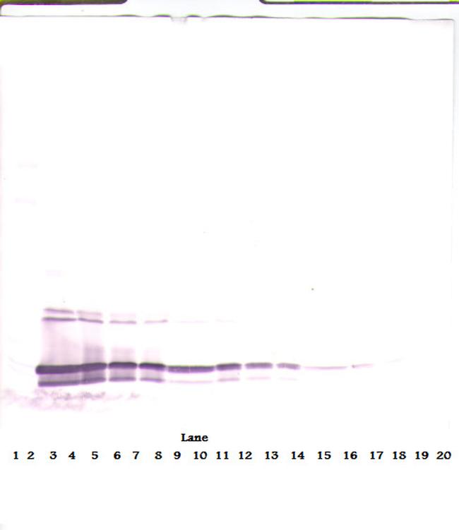 CTAGE5 Antibody in Western Blot (WB)