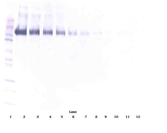 EGFR Antibody in Western Blot (WB)