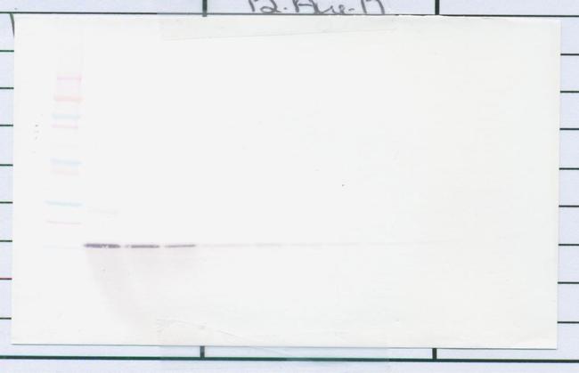 Amphiregulin Antibody in Western Blot (WB)