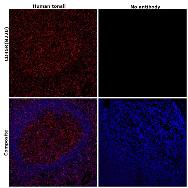 CD45R (B220) Antibody in Immunohistochemistry (Paraffin) (IHC (P))