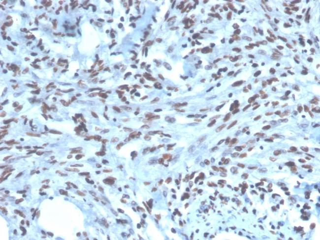 PAX2 (Renal Cell and Ovarian Carcinoma Marker) Antibody in Immunohistochemistry (Paraffin) (IHC (P))