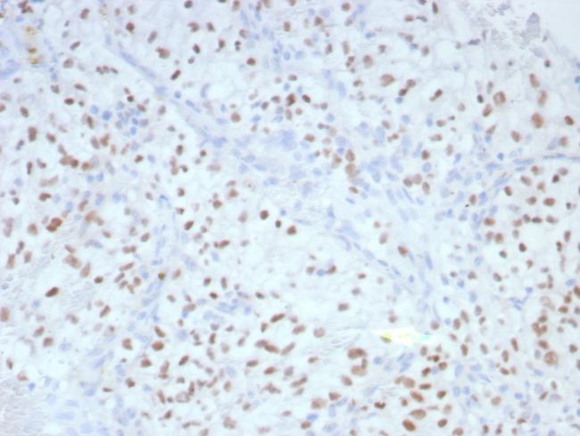 PAX2 (Renal Cell and Ovarian Carcinoma Marker) Antibody in Immunohistochemistry (Paraffin) (IHC (P))