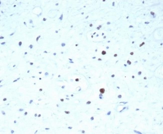 PAX7 (Rhabdomyosarcoma Marker) Antibody in Immunohistochemistry (Paraffin) (IHC (P))