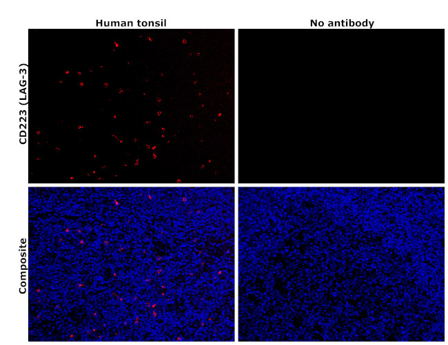 CD223 (LAG-3) Antibody in Immunohistochemistry (Paraffin) (IHC (P))