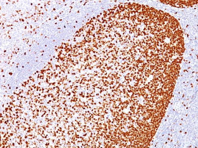 PCNA (Proliferating Cell Nuclear Antigen) (G1- and S-phase Marker) Antibody in Immunohistochemistry (Paraffin) (IHC (P))