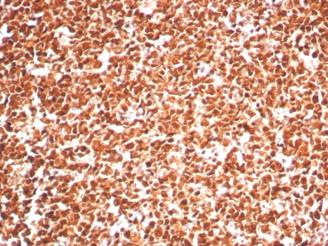 PCNA (Proliferating Cell Nuclear Antigen) (G1- and S-phase Marker) Antibody in Immunohistochemistry (Paraffin) (IHC (P))