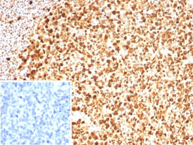 PCNA (Proliferating Cell Nuclear Antigen) (G1- and S-phase Marker) Antibody in Immunohistochemistry (Paraffin) (IHC (P))