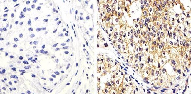 PTEN Antibody in Immunohistochemistry (Paraffin) (IHC (P))