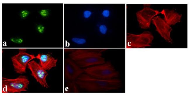 NFkB p50 Antibody in Immunocytochemistry (ICC/IF)