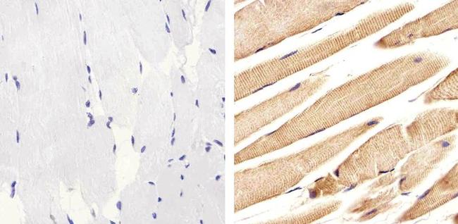 ALK Antibody in Immunohistochemistry (Paraffin) (IHC (P))