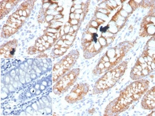 PDGF beta (PDGFB) Antibody in Immunohistochemistry (Paraffin) (IHC (P))