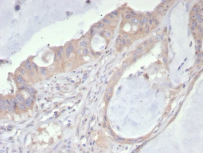 PDGFR-A (Platelet Derived Growth Factor Receptor, alpha)/CD140a Antibody in Immunohistochemistry (Paraffin) (IHC (P))