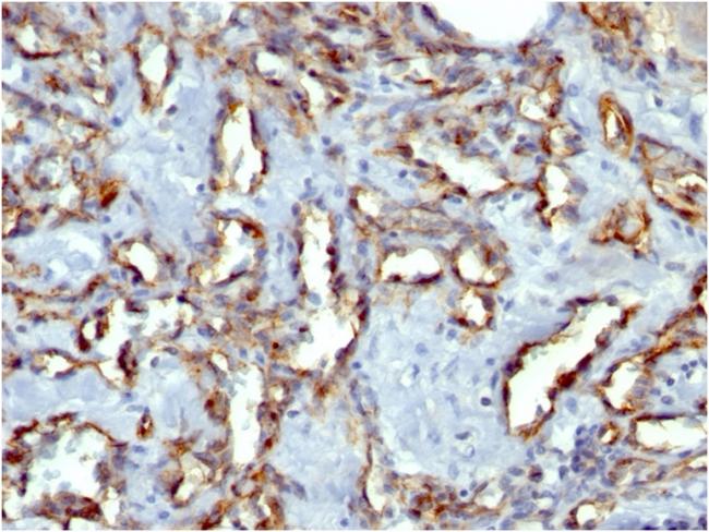 CD31/PECAM-1 (Endothelial Cell Marker) Antibody in Immunohistochemistry (Paraffin) (IHC (P))