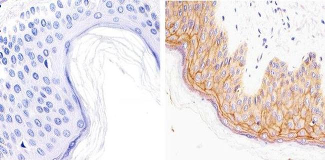 Claudin 1 Antibody in Immunohistochemistry (Paraffin) (IHC (P))