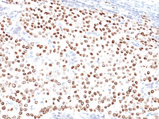 Progesterone Receptor (Marker of Progestin Dependence) Antibody in Immunohistochemistry (Paraffin) (IHC (P))