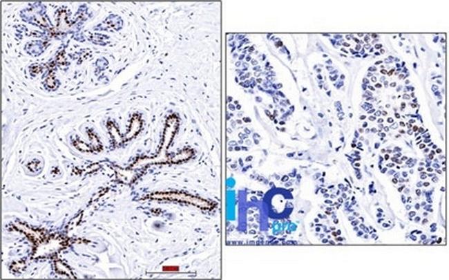 Progesterone Receptor (Marker of Progestin Dependence) Antibody in Immunohistochemistry (Paraffin) (IHC (P))