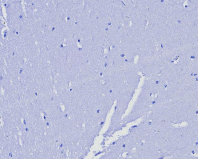 Progesterone Receptor (Marker of Progestin Dependence) Antibody in Immunohistochemistry (Paraffin) (IHC (P))