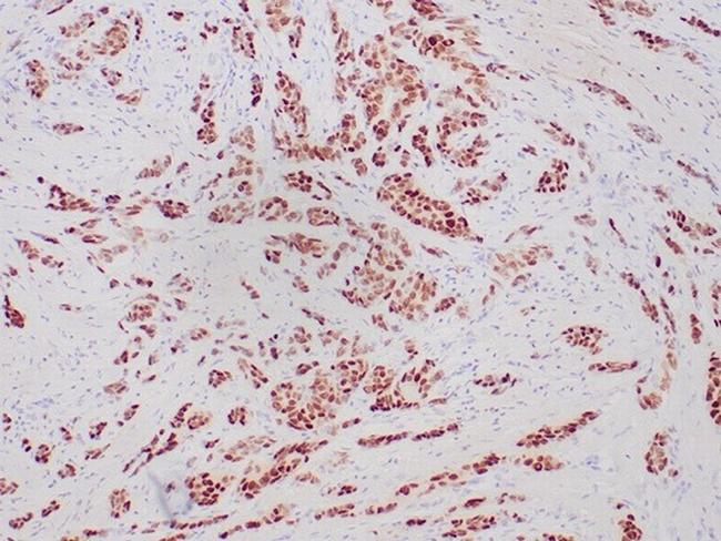 Progesterone Receptor (Marker of Progestin Dependence) Antibody in Immunohistochemistry (Paraffin) (IHC (P))