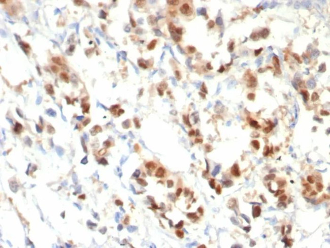 Progesterone Receptor (Marker of Progestin Dependence) Antibody in Immunohistochemistry (Paraffin) (IHC (P))